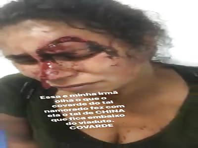 Woman victim of a damn coward has her head pierced