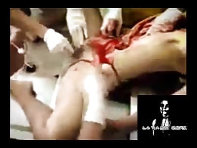Autopsy to woman with her legs open - La Tía Del Gore 