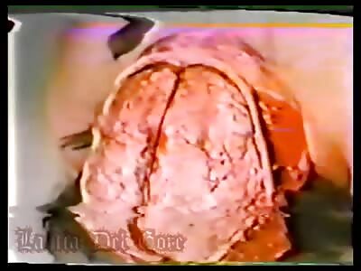 Old Autopsy VHS - La Tía Del Gore