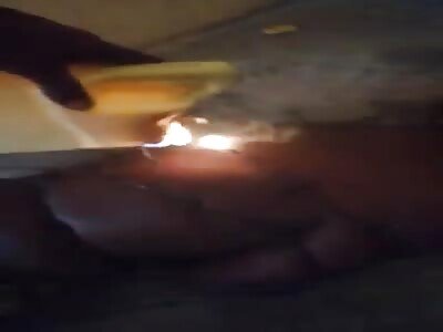 Molten Plastic Torture In Africa.