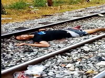 Time of pain, young man has leg amputated on the train line