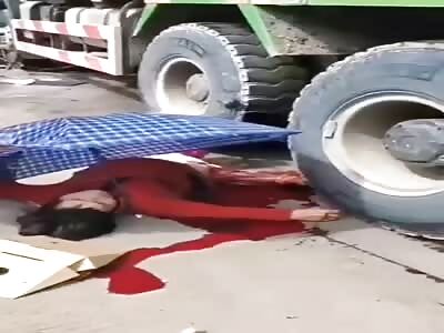 Victim with his legs crushed by truck