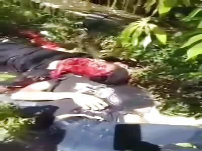 (Full Video) Man with face destroyed in accident