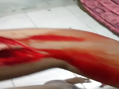 Small machete cut on arm