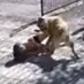 Poor Girl Mauled by Huge Dog
