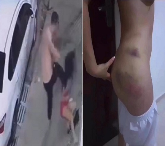 Scumbag Assaults Ex Girlfriend In Brazil