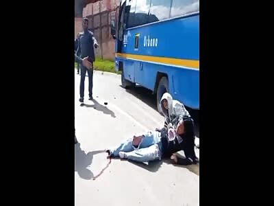 Girl had her foot chopped off by bus wheels