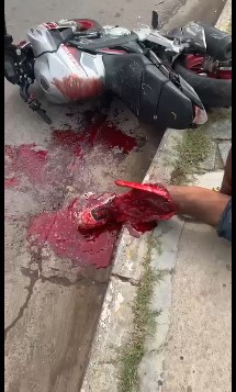 biker has his leg ripped off while drinking water
