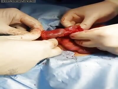 Surgery operation on a child