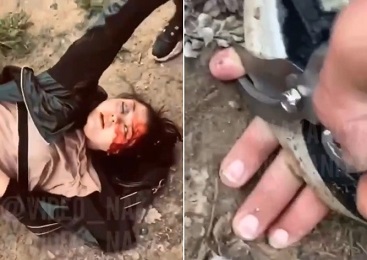 Woman Has Her Fingers Crudely Chopped Off with Gardening Pruner as Punishment
