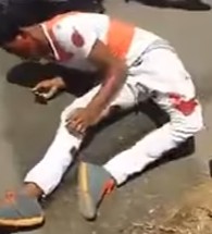 Guy in Agony Keeps Moving With His Broken Leg