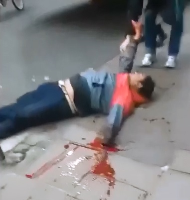 Angry Squirming Man Rolls Around with Severed Hand Bleeding Out on the Sidewalk..(Video sent from Top User marcochies)