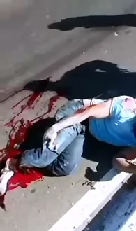 Motorcyclist keeps looking Down at his Foot because its Gone..