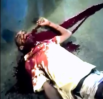 Slit in the Throat Losing All of his Blood and Dying on the Street 