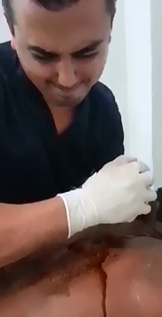 PULL...Doctor cant quite get it..Knife Stuck in Man's Back so Bad they cant Pull it Out 