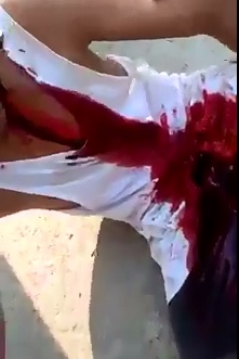 Pose for the Cameras..Kid with a Slit Throat Waits in Shock Bleeding Badly onto the Sidewalk 