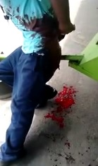 Man Bleeding Profusely After Stabbing