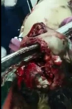 SHOCKING: Woman Still alive Impaled in the Face