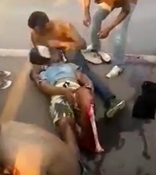 Man Trying to Comfort his Son who's Leg is Ripped Apart to the Bone
