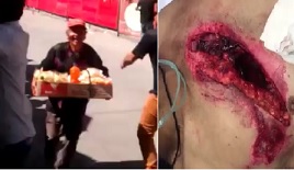 Bull Rips a Hole in Smiling Street Vendor (Action & Aftermath)