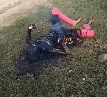 Young Woman Burnt to a Crisp in Morning BBQ.