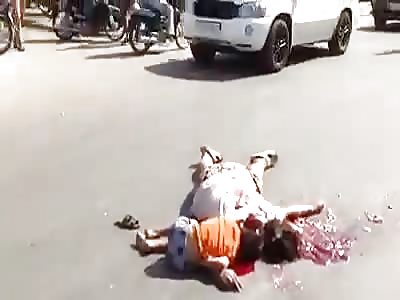 Mother and daughter with their heads busted after being run over by car