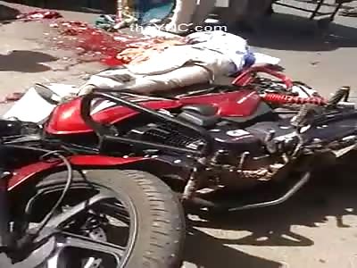 Innards Exposed In The Street Of A Man Biker Crushed By Truck
