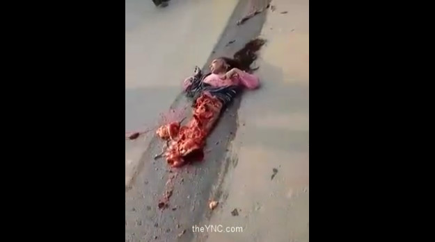 The Woman Crushed And Ripped Apart By A Truck .