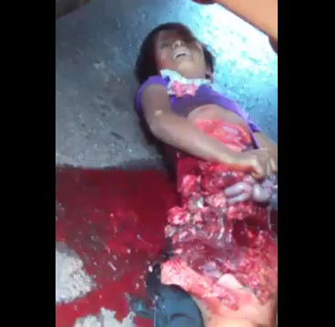 SHOCKING and SAD: Litle Girl in Agony Still Alive after Being Crushed by a Truck