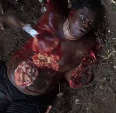[FULL]Gruesome Video Shows Man being Dismembered Alive