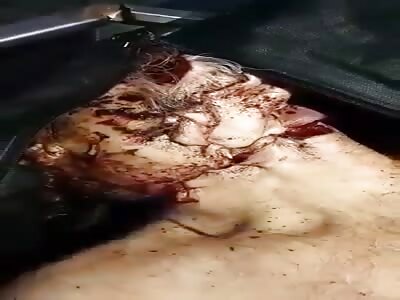 Mutilated corpse.