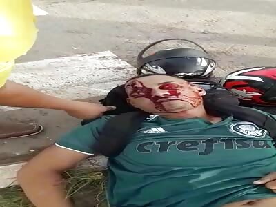 VICTIM OF MOTORCYCLE ACCIDENT