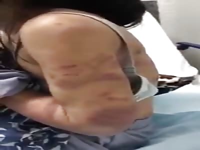 Asian maid tortured by Saudis boss