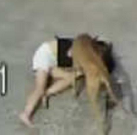 Stray Dog Brutally Attacks Girl, Bites Off Her Face In India