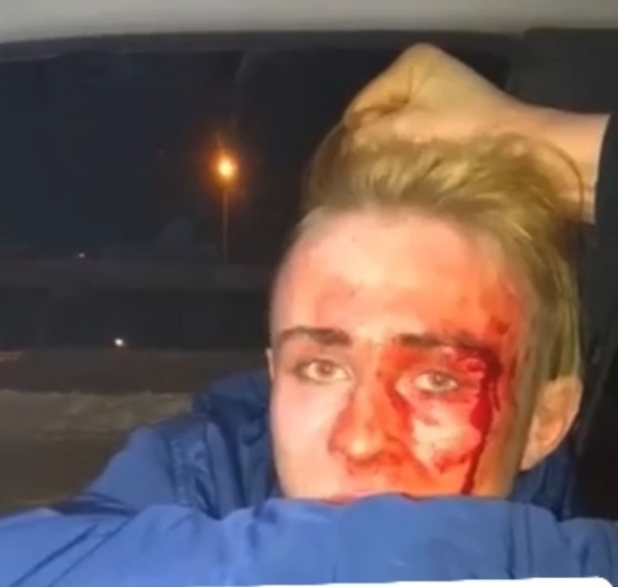 Russian young man humiliated and gets beaten for being a gay