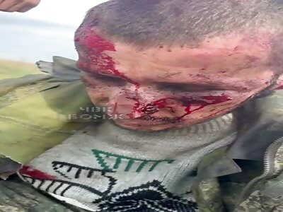 Wounded Russian soldier captured by ukranian 