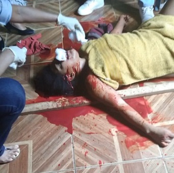 Girl Slashed In Face By His Stepfather 
