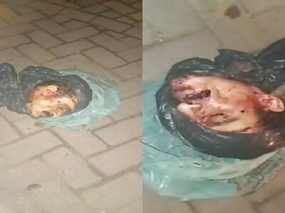 In the streets of Brazil they find a decapitated head