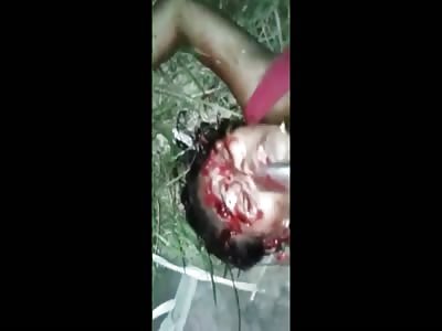 {Repost} HD Version Of 15 Year Olds Head Smashed With Hammer+Knife To Face