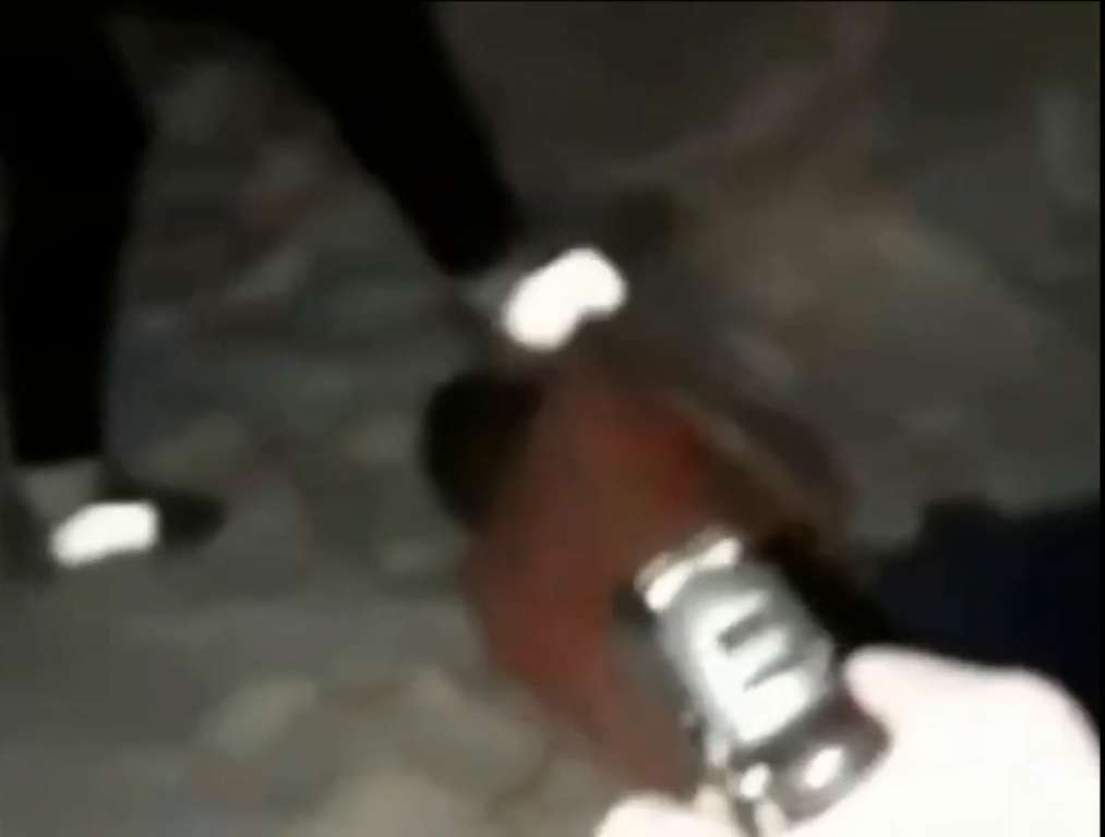 Drug Dealers Break Fingers/Hands And Stomp The Shit Out Of People
