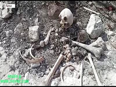 The discovery of human bones from first karabakh war in Azerbaijan