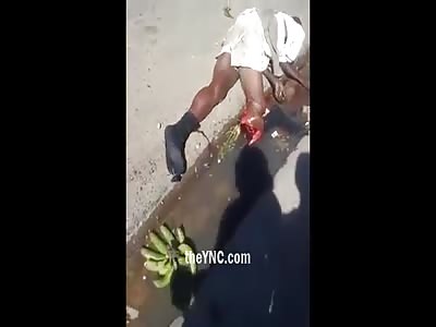 Man in his Agony Lying on the Street With Broken Leg