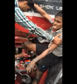 Young Motorcyclist with his Broken Leg Embedded in the Bus