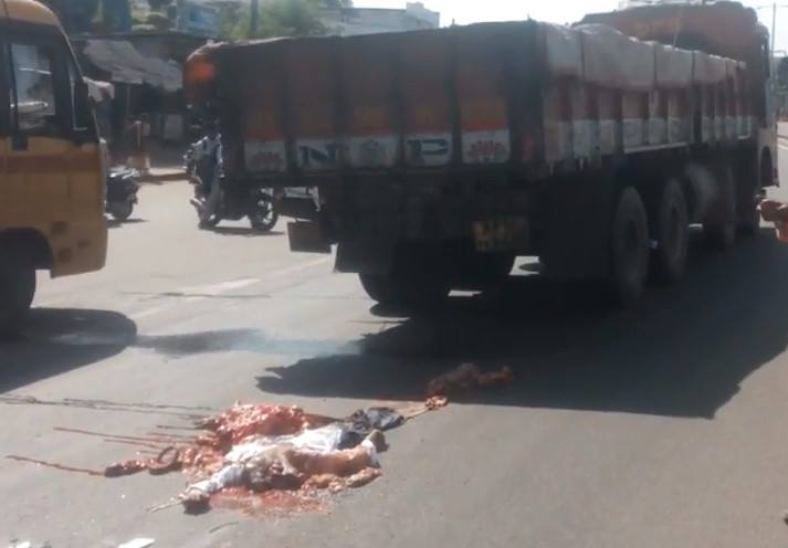 Man lies in his Entire Digestive System in the Street after being Crushed by Truck 
