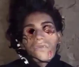 Tranny Snitch Found with His Eyes Removed by Drug Dealers 