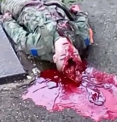 Colombian Soldier with Skull Split Open after Suicide 