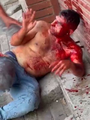 Bloody Mob Justice In Chile
