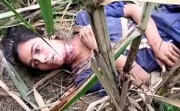 Girl is Fully Awake With a Throat Slit