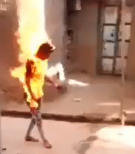Man Became Human Torch After Gas Oven Explosion