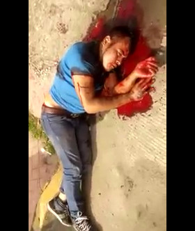 (New Version) Thief Losing a Lot of Blood After Getting Shot by Victim 